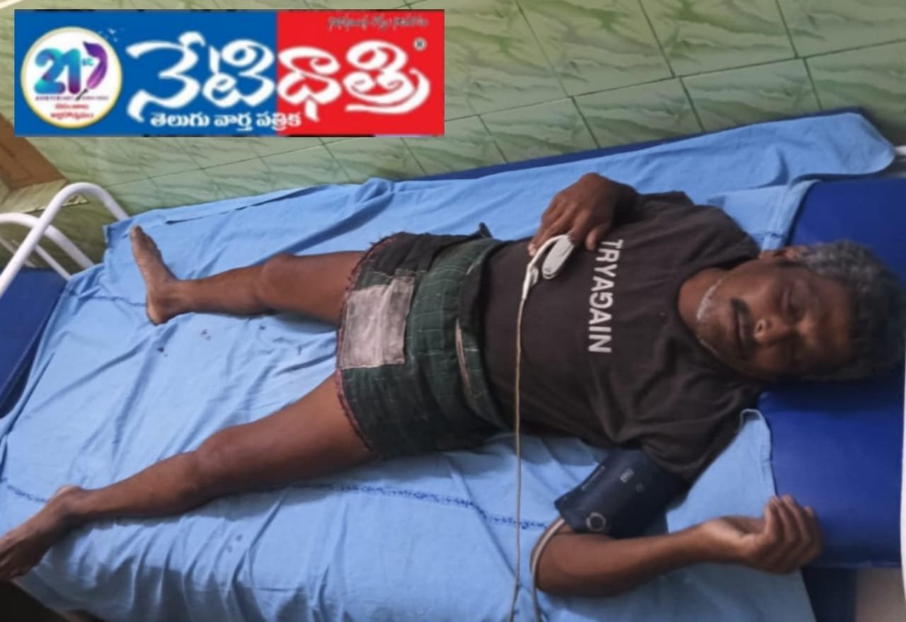 గీత కార్మికుడికి తీవ్రంగా గాయాలు.