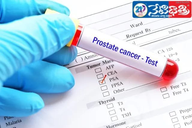 cancer test