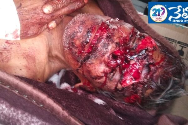 వీధి కుక్కల దాడిలో.. ఓ వ్యక్తికి తీవ్ర గాయాలు. Dog Attack.