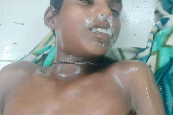 మనస్థాపంతో క్రిమిసంహారక మందు తాగి బాలుడు ఆత్మహత్య. Boy commits suicide