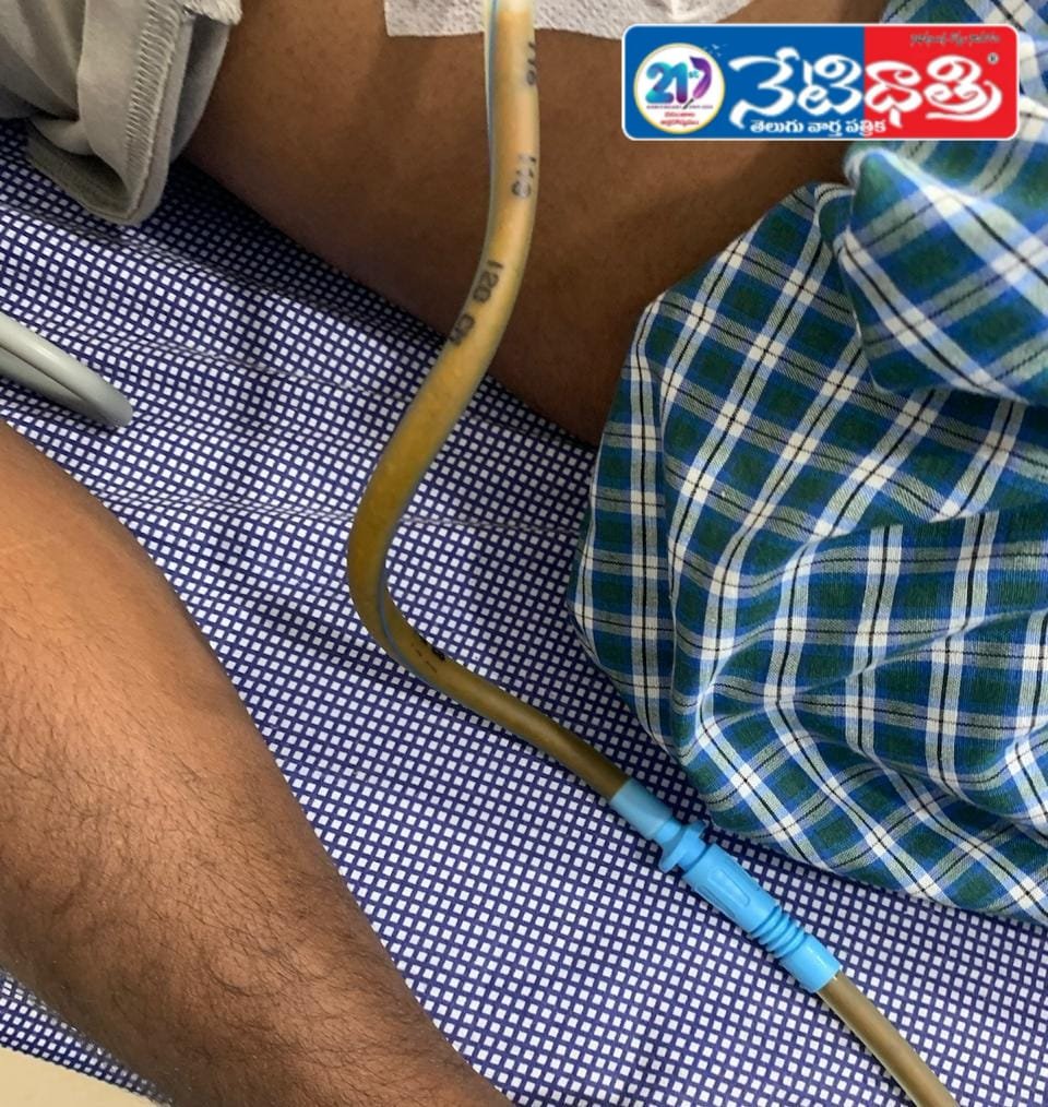 BANDAN HOSPITAL CRIMES HANAMKONDA