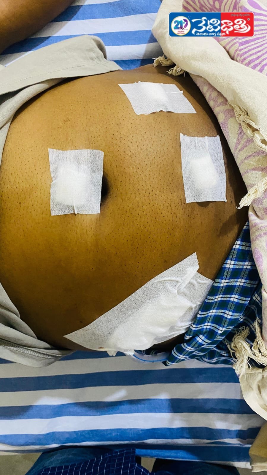 BANDAN HOSPITAL CRIMES HANAMKONDA