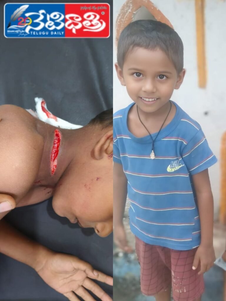 Injured Boy'