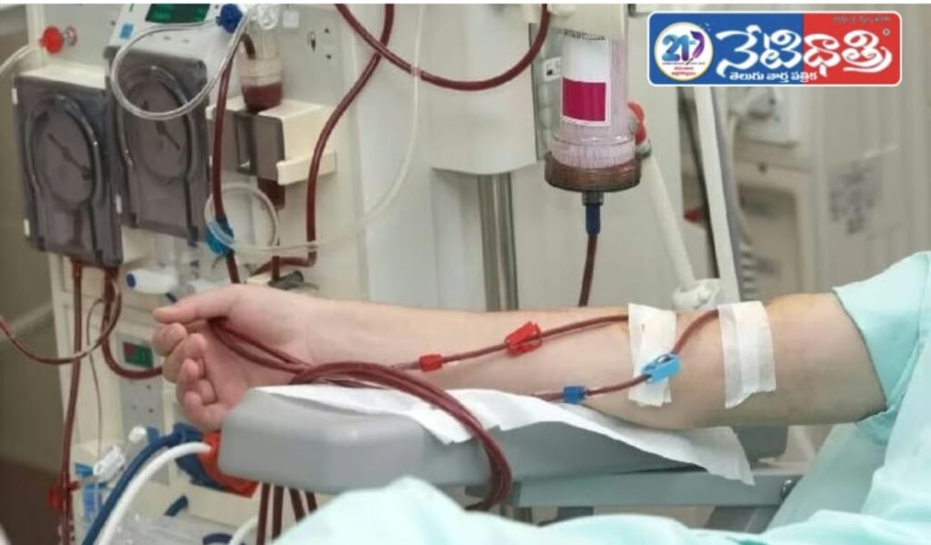 Dialysis Myths vs Facts