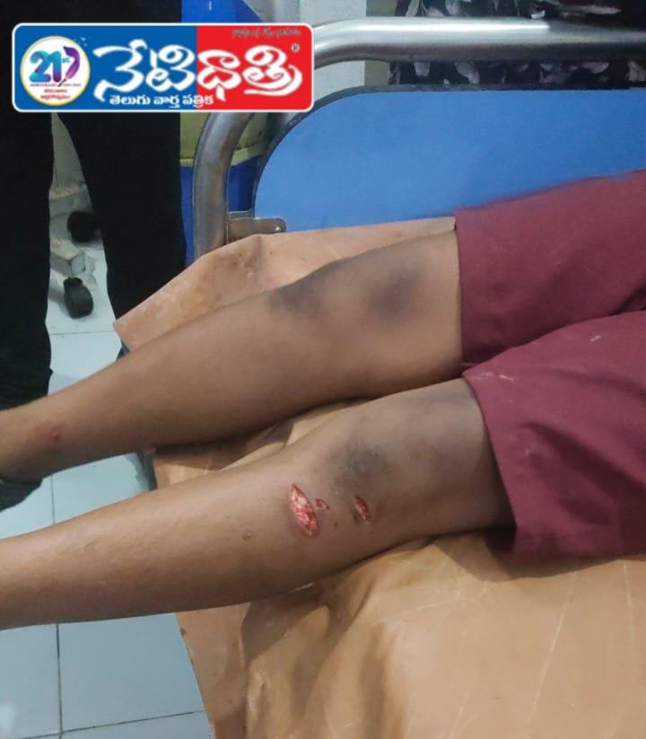 Dog Menace in Sircilla