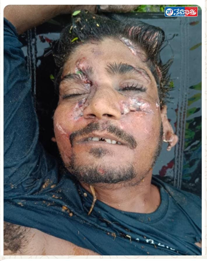 The deceased was wearing a navy blue full T-shirt and navy blue bottoms.