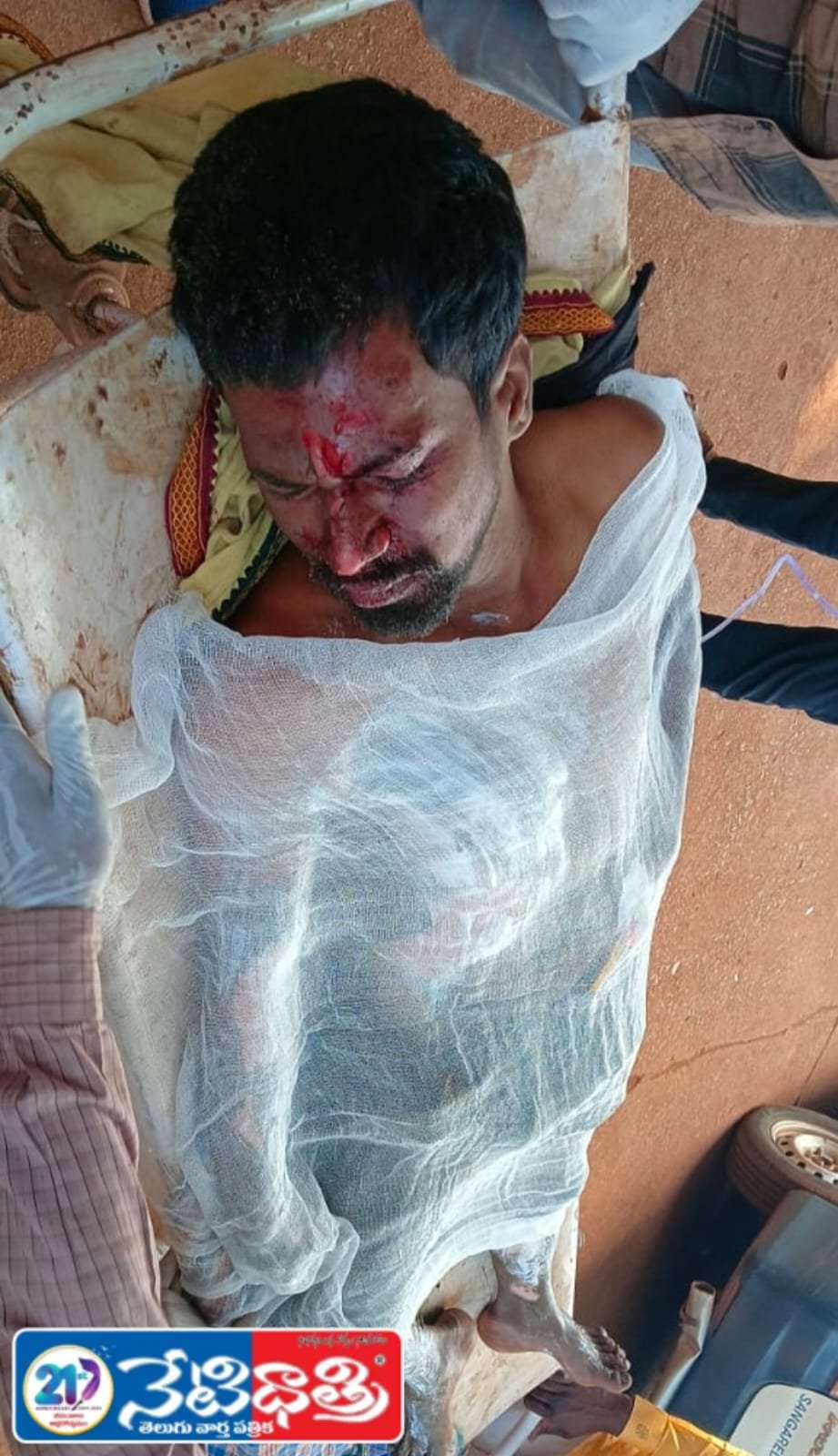 Youth Injured by Electric Shock While Flying Kite in Zaheerabad