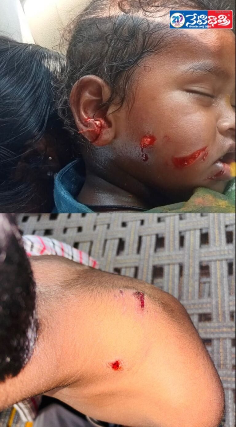 Stray Dog Attack Injures Several in Villages