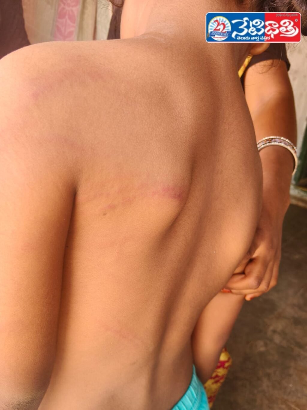 Teacher Assaults Student in School Incident