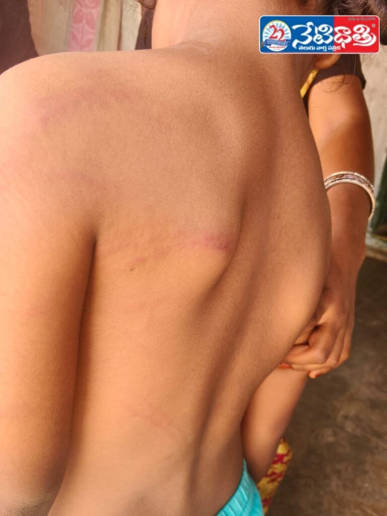 Teacher Assaults Student in School Incident